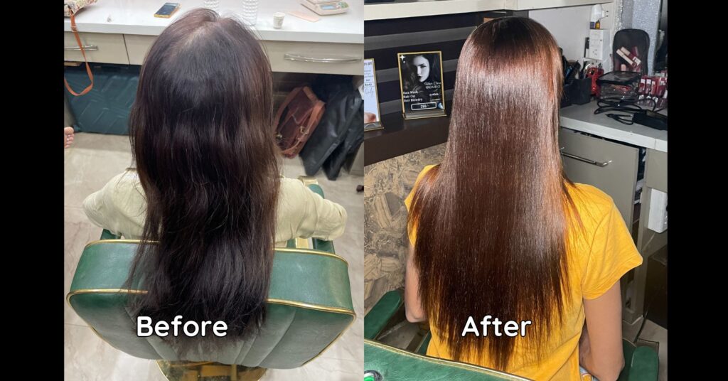 Nanoplastia transformation at parlour in Jabalpur